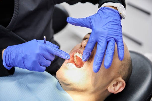 Best Emergency Denture Repair in Cloverdale, CA